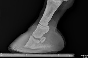 radiograph of hoof treated for laminitis